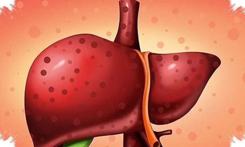 Indonesia Kejar Eliminasi Hepatitis 2030 Saat 90% Pengidap Belum Tahu Statusnya