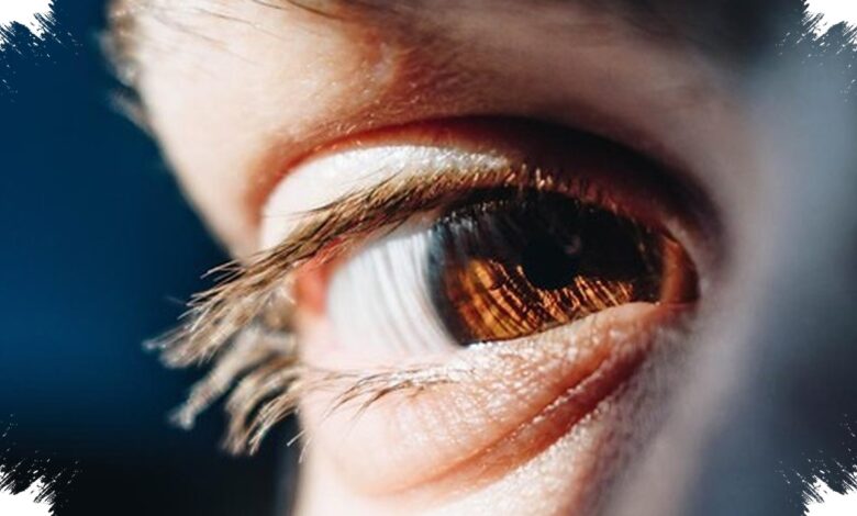 Tak Hanya Membuat Wajah Sayu, Ptosis Bisa Menutup Pupil dan Menghambat Aktivitas