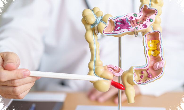 Tidak Semua Radang Apendiks Harus Dioperasi, Ini Batas Aman Terapi Antibiotik